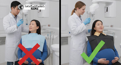 رادیولوژی دندان در بارداری | ایمنی و نکات مهم در فردیس کرج